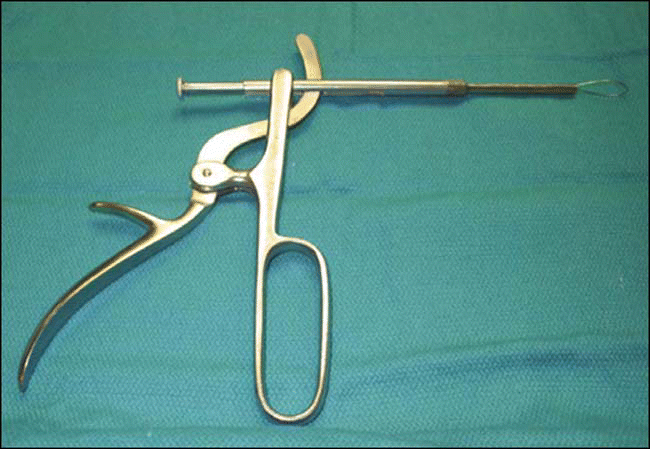 Figure. Cold steel tonsillectomy offers the most economic choice of equipment-two wires for a snare (pictured) cost approximately $1.63.