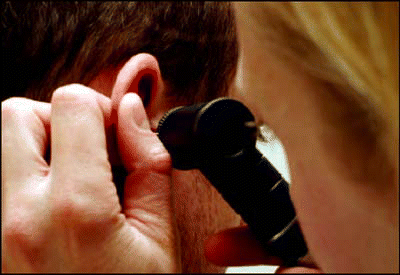 Figure. SSHL occurs most often in people between ages 30 and 60; a number of causal ideologies have been proposed.