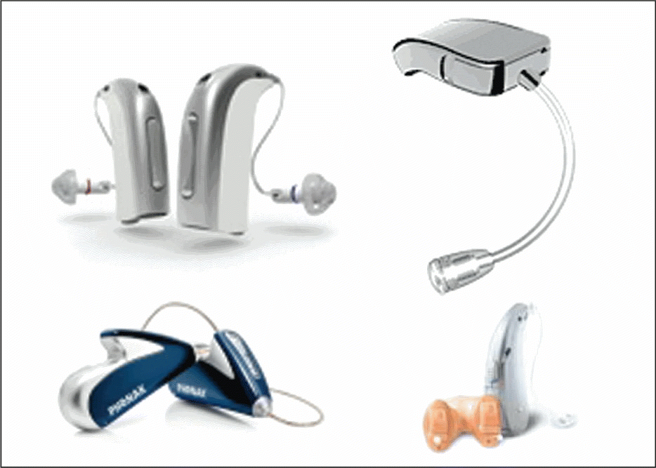 Figure. Some of the currently available hearing aids are (clockwise from left) EpoqRITE by Oticon, be by ReSound, Siemens Motion, and Phonak's Audéo YES.