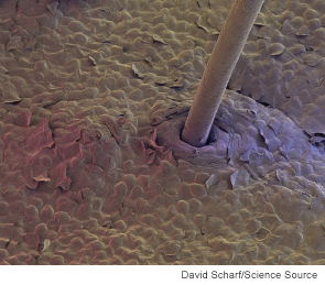 New Therapies for Hair Transplantation