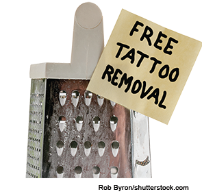 Tips for Adding Tattoo Removal to Your Practice