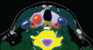 Updated Thyroid Nodule Guidelines Give Recommendations on Diagnosis, Treatment