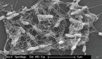 Scanning electron microscopy image showing active biofilm formation detected on the surface of a nasal irrigation bottle.