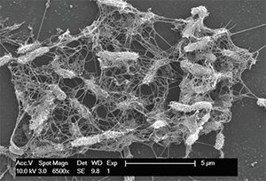Scanning electron microscopy image showing active biofilm formation detected on the surface of a nasal irrigation bottle.