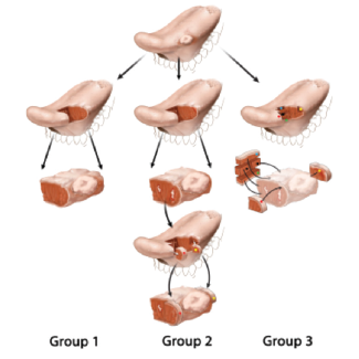 An exophytic tumor at the lateral border of the oral tongue is illustrated. In group 2, white irregular areas represent residual carcinoma at the margin. In groups 2 and 3, colored dots represent tumor bed margins.