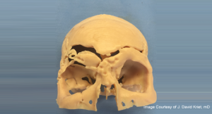 Image Courtesy of J. David Kriet, mD