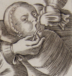 Wood block of a physician performing a frenectomy, dated 1679.