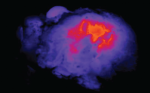 Image of light shining through a tumor specimen.