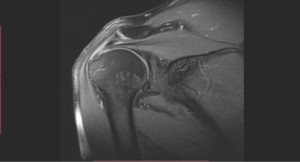 wei xray