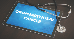 Oropharyngeal Cancer