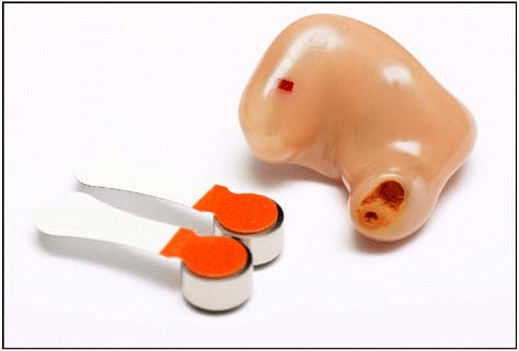 Figure. Otolaryngologists have the ability to correctly diagnose hearing problems and prescribe the proper devices to correct them.