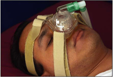 Figure. Educating patients about CPAP and getting them to try it out gradually can help gain acceptance.