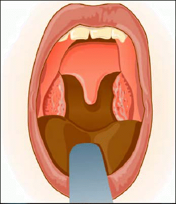 Figure. A thorough examination is key to correct diagnosis of obstructive sleep apnea.