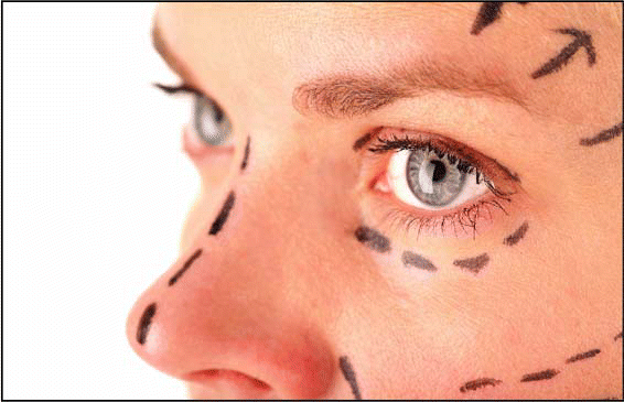 Figure. It is important to discuss symmetry and proportion with the patient before performing a rhinoplasty.