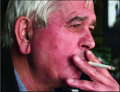 Figure. Smokers may indeed benefit from endoscopic sinus surgery for chronic sinusitis.