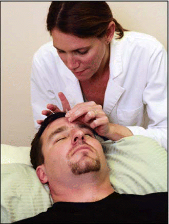 Figure. Patients in the study received needles in the hairline, hand, leg, ear, and other locations according to their symptoms.