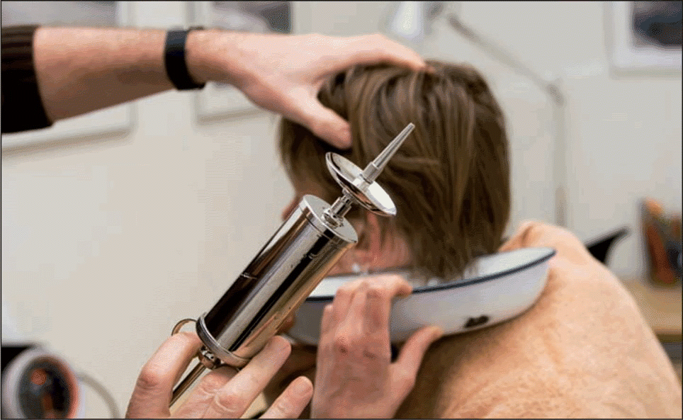 Figure. The new AAO-HNS guidelines include a recommendation for professionals to use cerumenolytic agents, irrigation, or manual removal other than irrigation to extract cerumen.