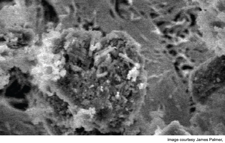 A pseudomonas biofilm from a paranasal sinus.