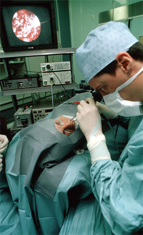 A surgeon using a nasal endoscope to help remove sinus mucosa from the patient’s sinuses.