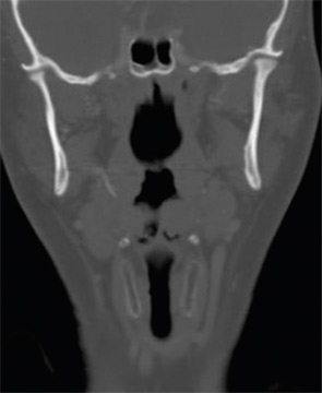 Figure 2: Axial CT scan.