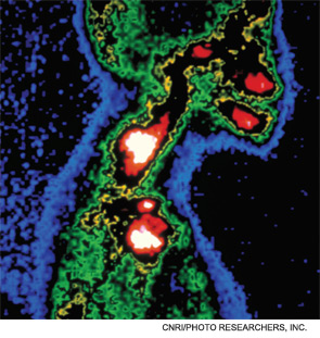 The study involved 230 patients treated for head and neck squamous cell carcinoma.