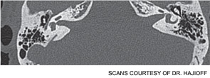 axial CT scans