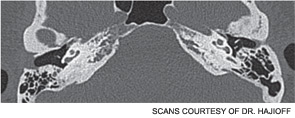 axial CT scans