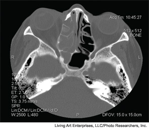 xial (cross sectional) CT