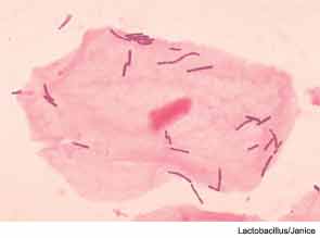 Lactobacilli could lower the surrounding pH through their production of lactic acid.