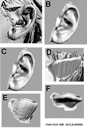 The anatomy of a 5-year-old female was scanned