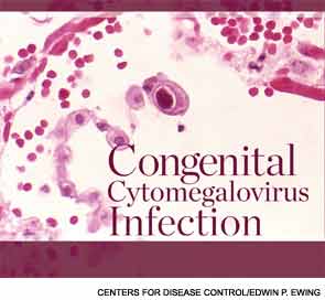 Congenital Cytomegalovirus Infection